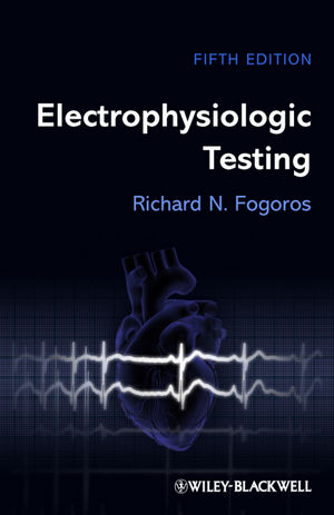 Electrophysiologic testing