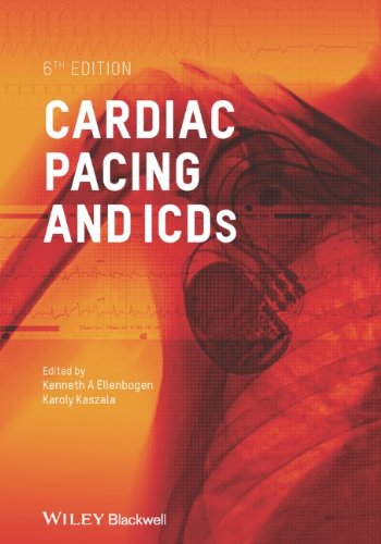 Cardiac Pacing and Icds 6e