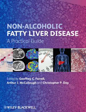 Non-alcoholic fatty liver disease : a practical guide