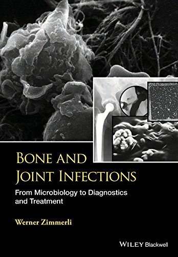 Bone and Joint Infections