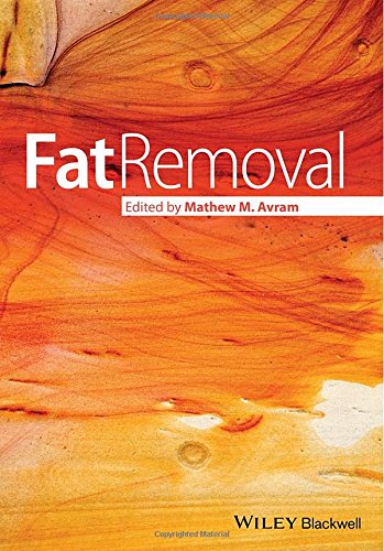 Fat Removal