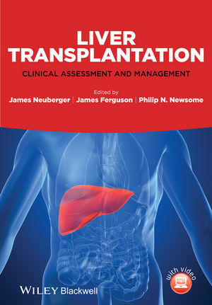 Liver Transplantation Clinical Assessment and Management.