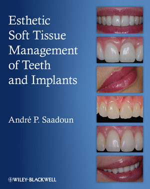 Esthetic soft tissue management of teeth and implants