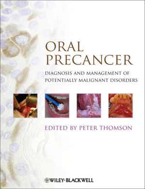 Oral Precancer : Diagnosis and Management of Potentially Malignant Disorders.