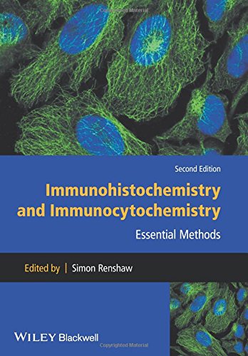 Immunohistochemistry