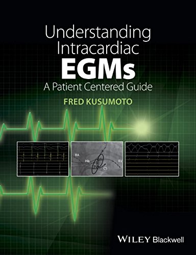 Understanding Intracardiac Egms