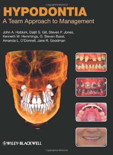 Hypodontia : a Team Approach to Management