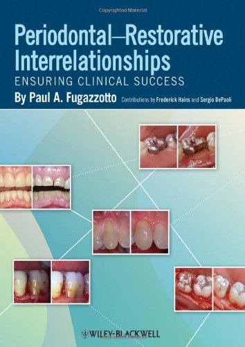 Periodontal-Restorative Interrelationships : Ensuring Clinical Success