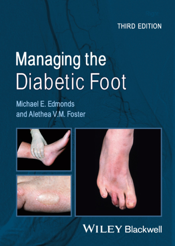 Managing the diabetic foot