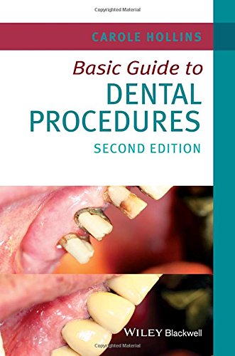 Basic Guide to Dental Procedures