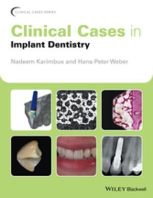 Clinical Cases in Implant Dentistry