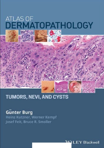 Atlas of Dermatopathology