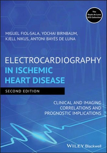 Electrocardiography in ischemic heart disease : clinical and imaging correlations and prognostic implications