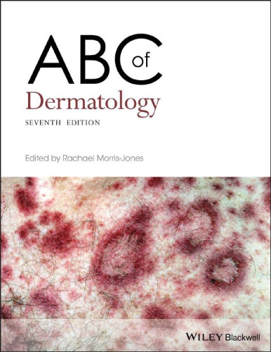 ABC of Dermatology