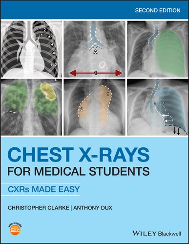 Chest X-Rays for Medical Students