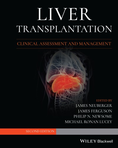 Liver Transplantation