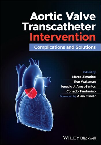 A Practical Guide to Prevention and Treatment of Complications During Transcatheter Aortic Valve Implantation