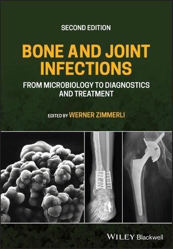 Bone and Joint Infections