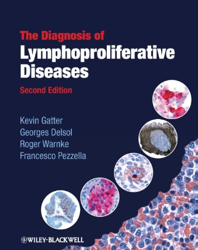 The diagnosis of lymphoproliferative diseases