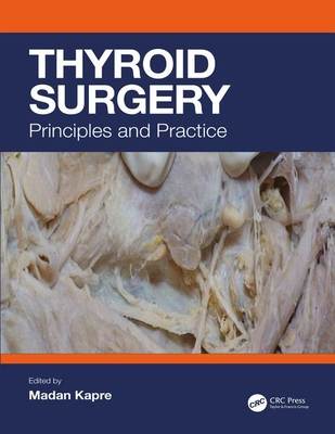 Thyroid Surgery