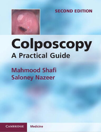 Colposcopy