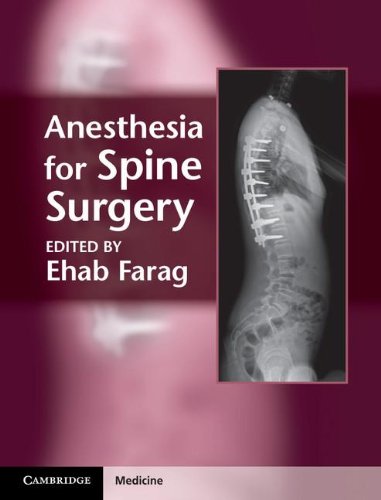 Anesthesia for Spine Surgery.