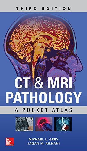 CT &amp; MRI Pathology