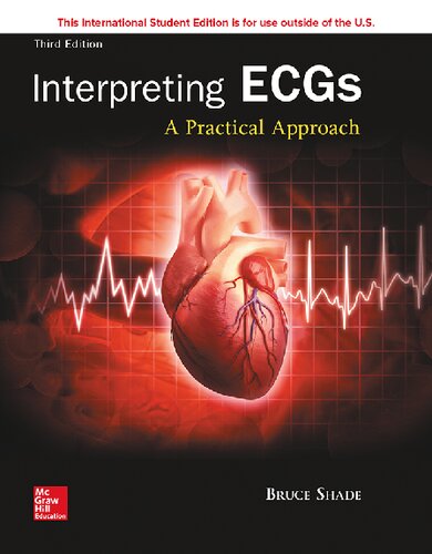 Interpreting ECGs : a practical approach