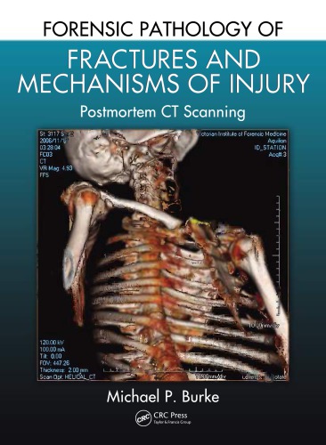 Forensic Pathology of Fractures and Mechanisms of Injury