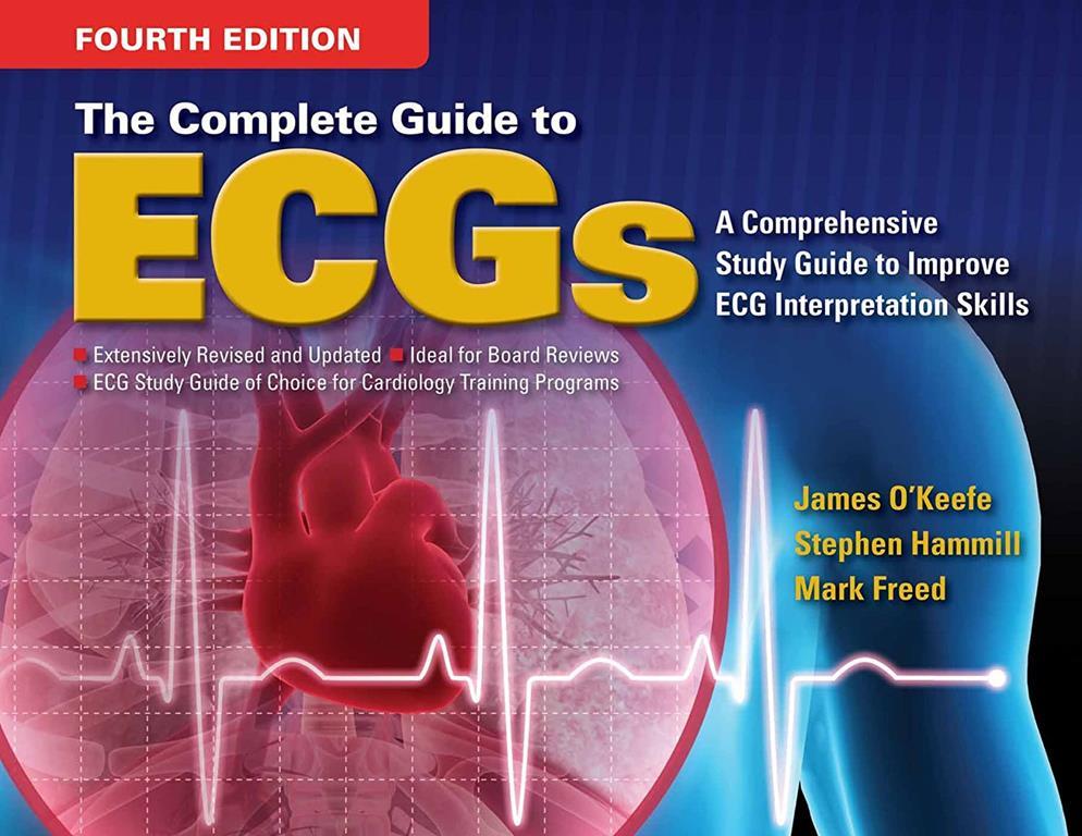 The Complete Guide to ECGs