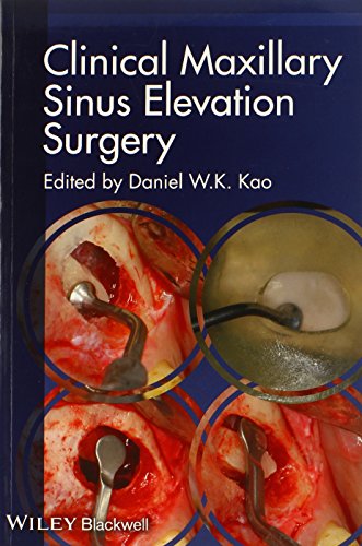 Clinical Maxillary Sinus Elevation Surgery