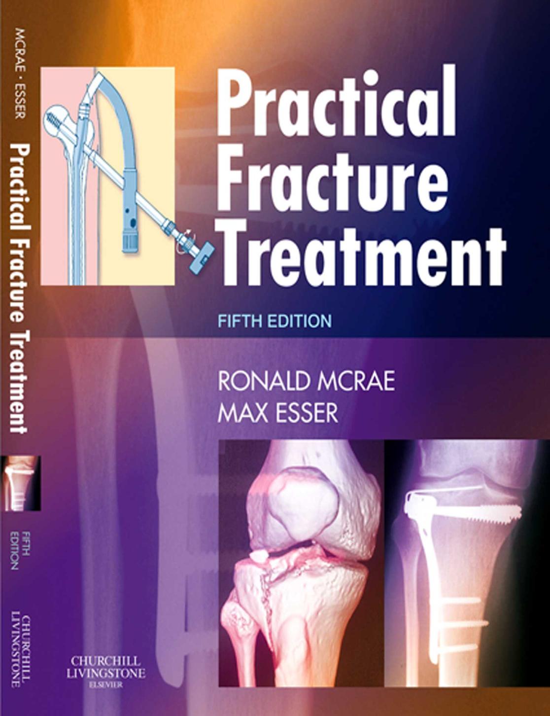 Practical Fracture Treatment.