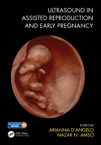 Ultrasound in assisted reproduction and early pregnancy