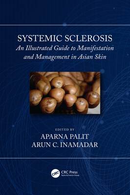 Systemic Sclerosis