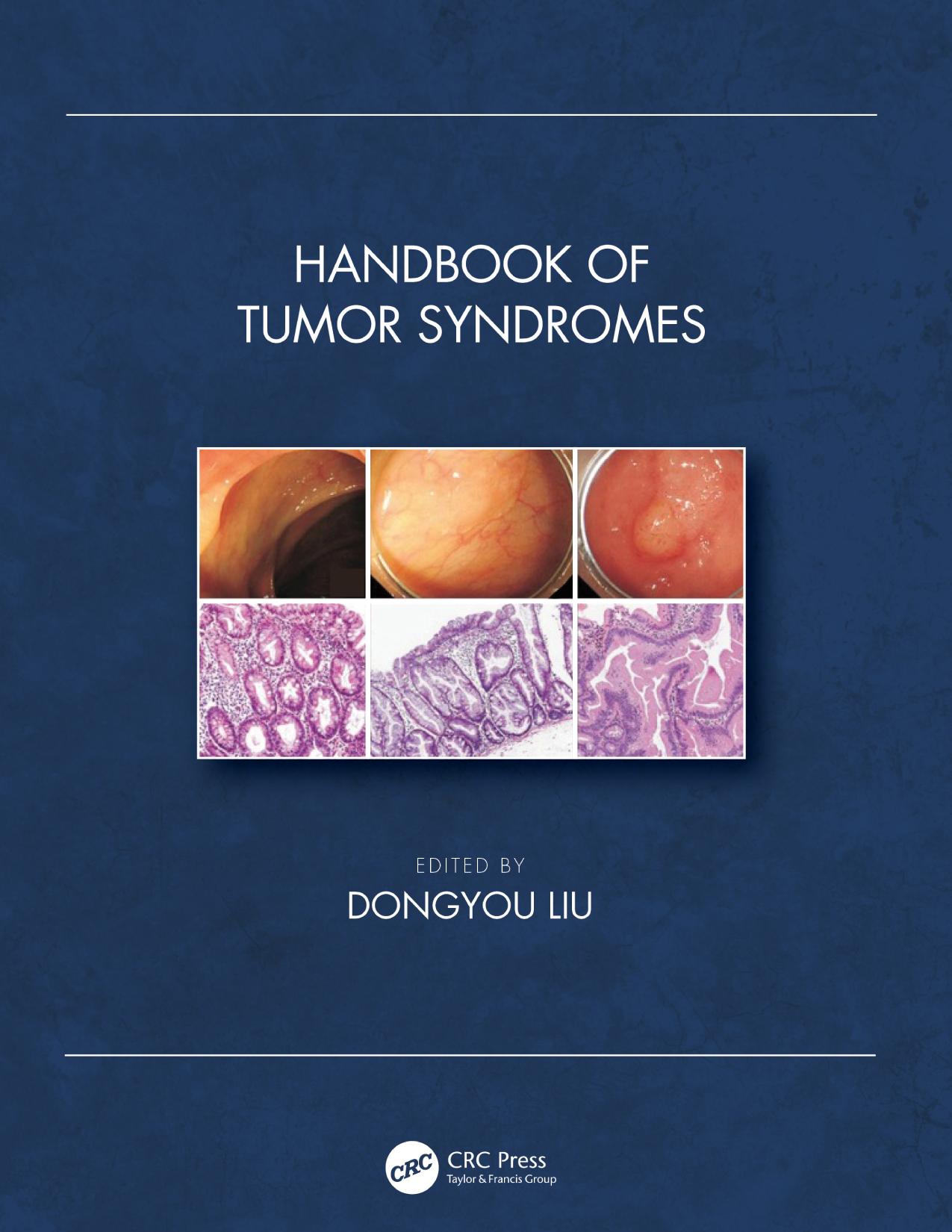 Handbook of Tumor Syndromes