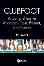 Clubfoot : a comprehensive approach (past, present, and future)