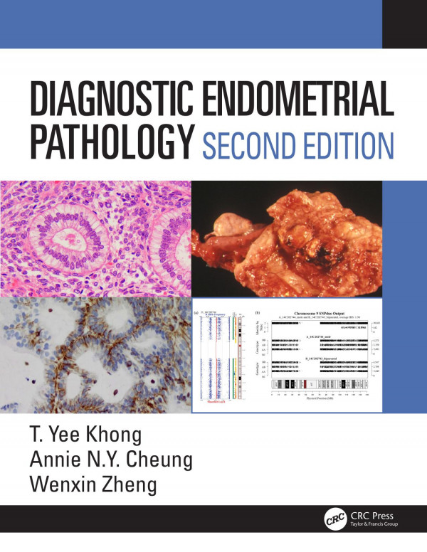 Diagnostic Endometrial Pathology 2e