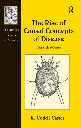 The Rise of Causal Concepts of Disease