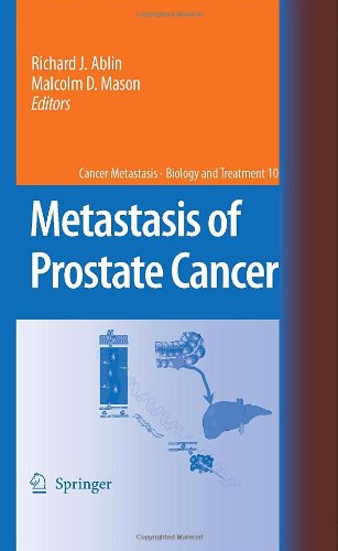 Metastasis of Prostate Cancer