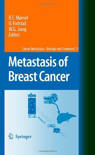 Metastasis of Breast Cancer (Cancer Metastasis - Biology and Treatment, 11)