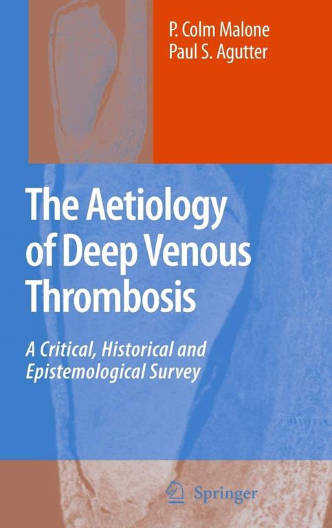 The Aetiology of Deep Venous Thrombosis