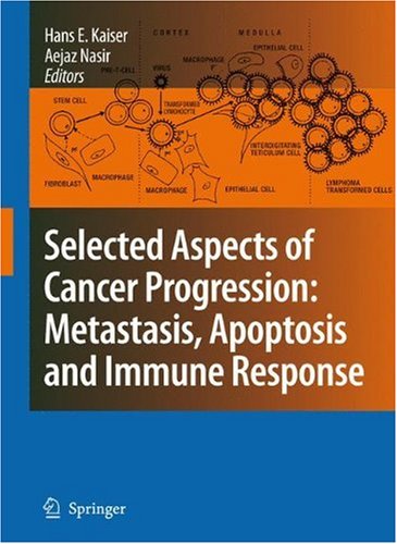 Selected Aspects of Cancer Progression: Metastasis, Apoptosis and Immune Response