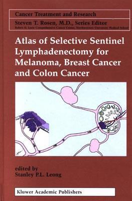 Atlas of Selective Sentinel Lymphadenectomy for Melanoma, Breast Cancer and Colon Cancer