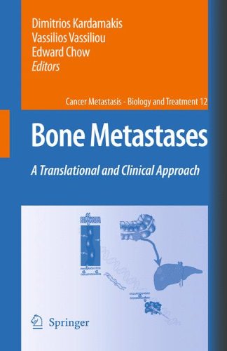 Bone Metastases