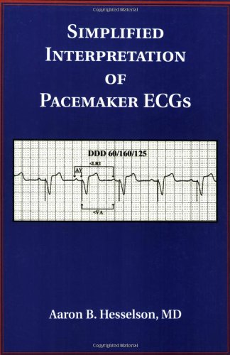 Simplified Interpretation of Pacemaker Ecgs