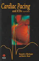 Cardiac Pacing And Icds