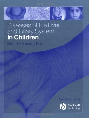 Diseases Of The Liver And Biliary System In Children