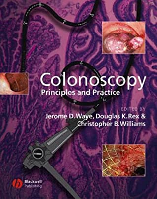 Colonoscopy