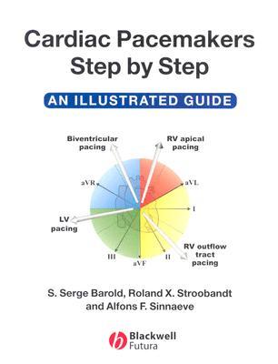 Cardiac Pacemakers Step-By-Step