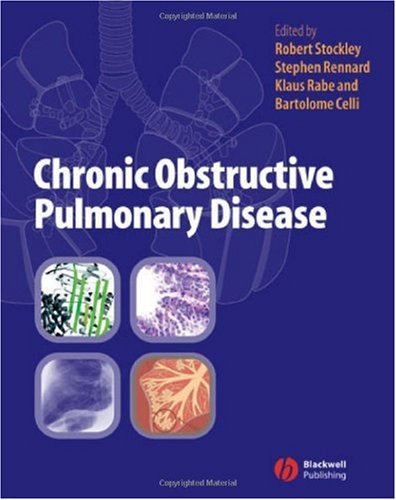 Chronic Obstructive Pulmonary Disease